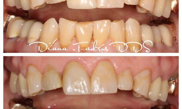 Beauty and the Teeth: Dr. Diana Tadros DDS