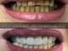 Florida Coast Dental: Cosmetic & Dental Implant Center