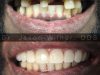 Florida Coast Dental: Cosmetic & Dental Implant Center