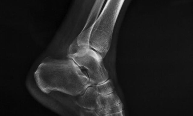 Christopher J. Pappas, DPM