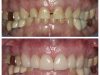 Restorative and Implant Dentistry