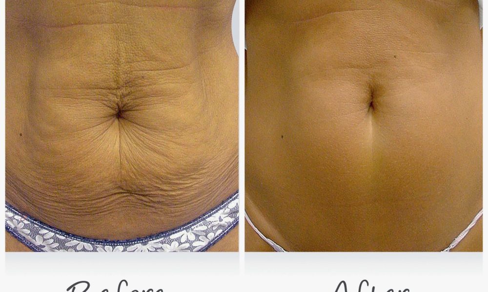 Body Contour Wellness Center