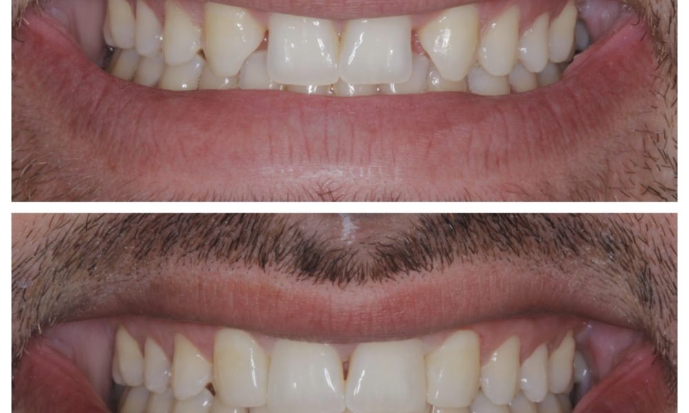 Restorative and Implant Dentistry