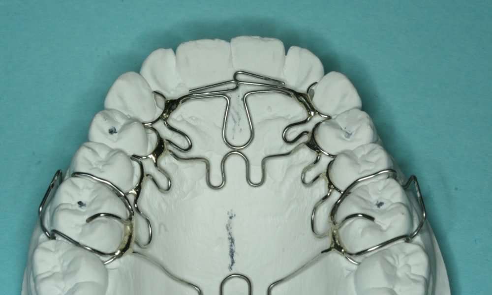 Single Visit Dentistry