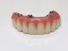 My Pompano Dentist Andrew Browne DDS PA