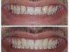 Restorative and Implant Dentistry