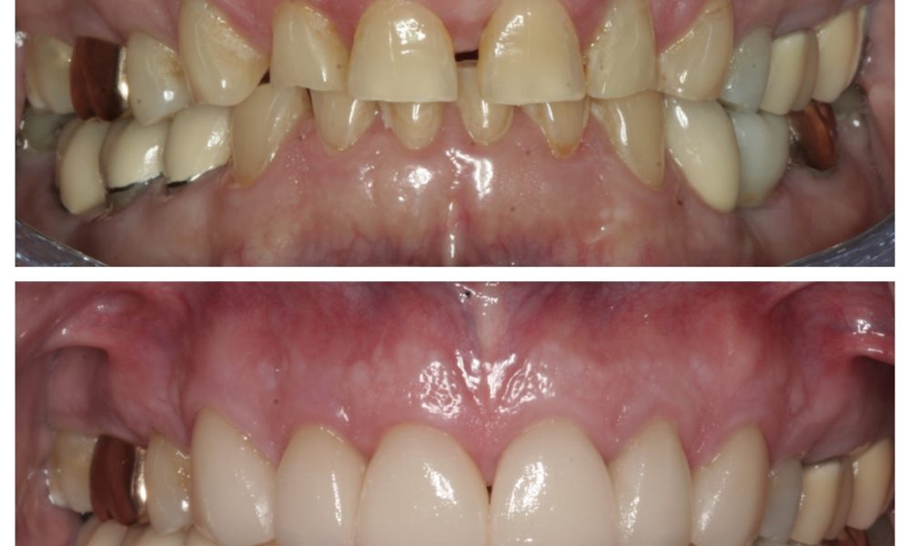 Restorative and Implant Dentistry